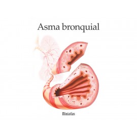 Asma Bronquial - Envío Gratuito